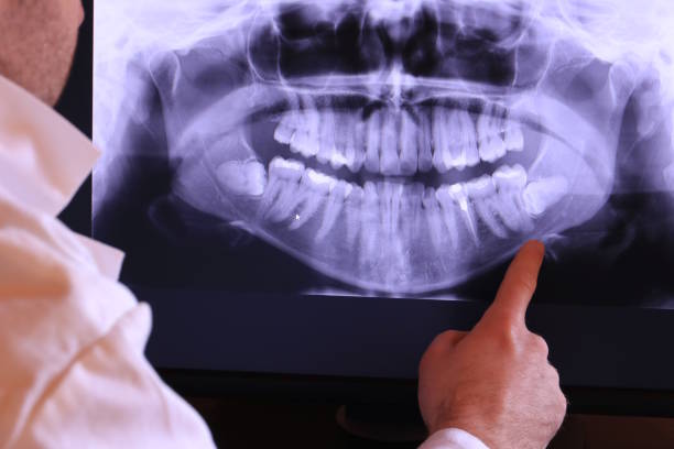 Best Emergency Treatment for Toothache in West Pensacola, FL
