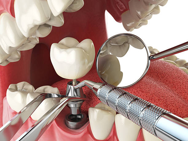 Best Emergency Dental Care for Trauma or Injury in West Pensacola, FL